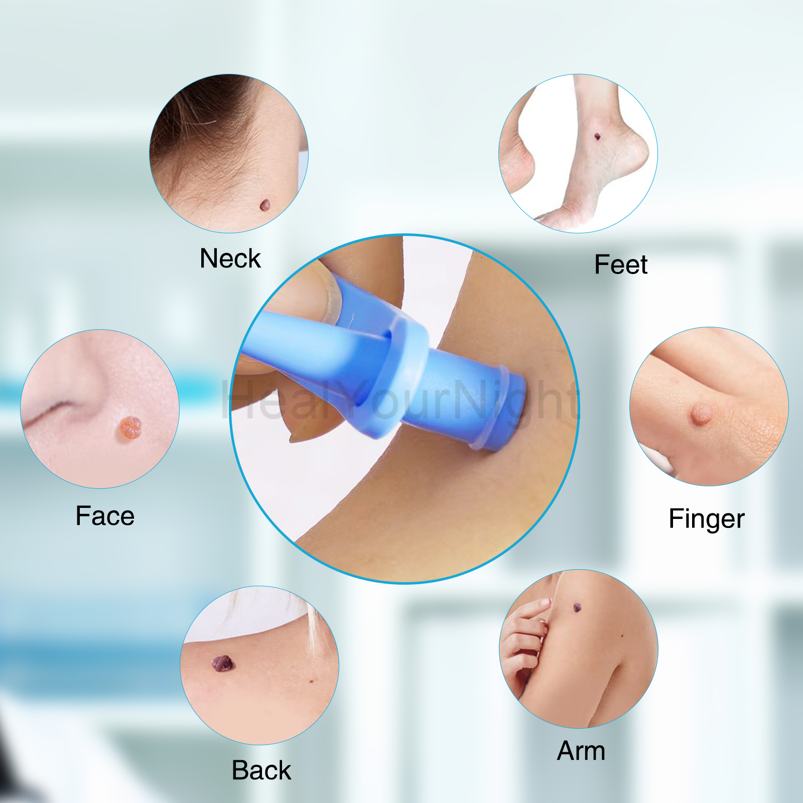 3-IN-1 Auto Skin Tag Removal K - مراجعة Luxury Skincare Acne وسعره