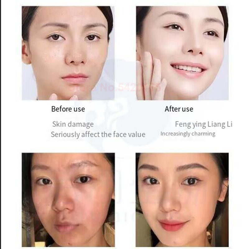 Blue Copper Peptide Freeze-Dri - مراجعة Oligopeptide Wrinkle وسعره