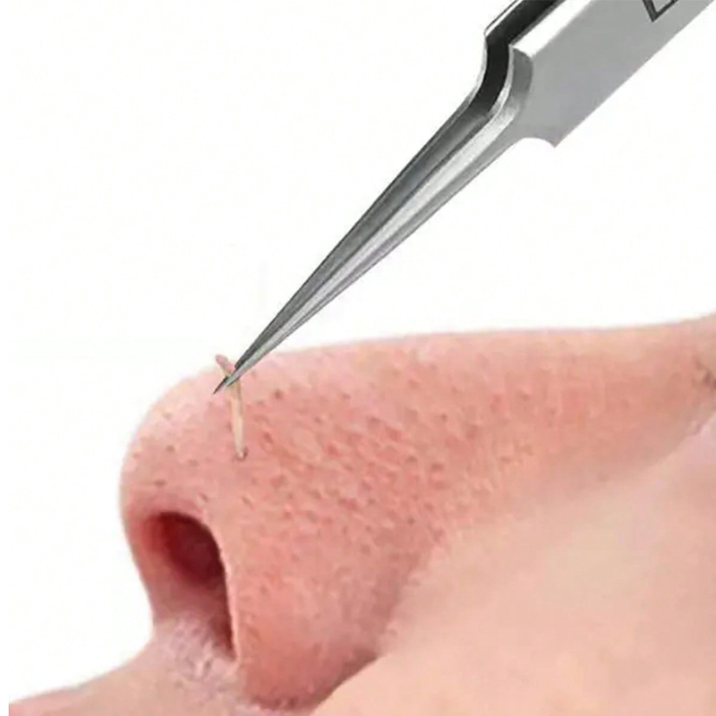 4/6PCS Face Cleaning Kit Pimpl - مراجعة Luxury Skincare Acne وسعره