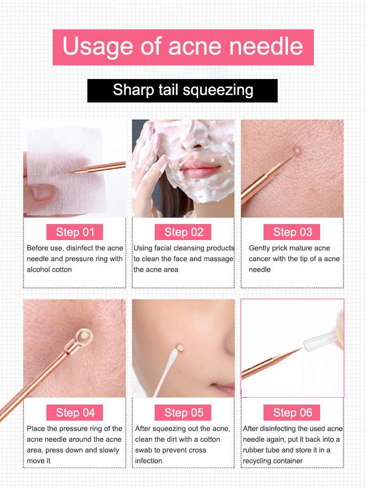 Blackhead Remover Pimple Comed - مراجعة Luxury Skincare Acne وسعره