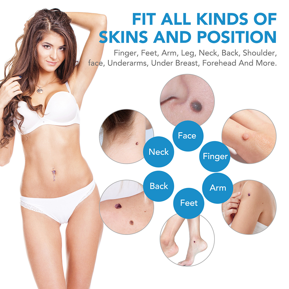 2-IN-1 Auto Skin Tag Removal T - مراجعة Luxury Skincare Acne وسعره