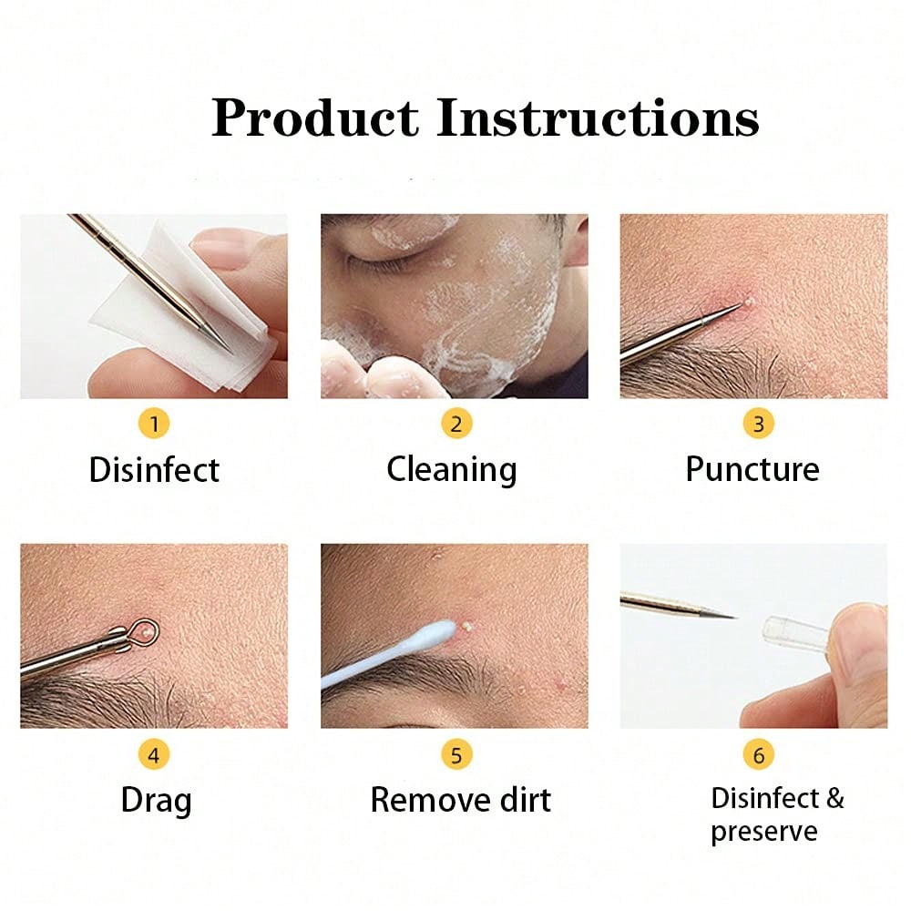 4-piece stainless steel comedo - مراجعة Luxury Skincare Acne وسعره
