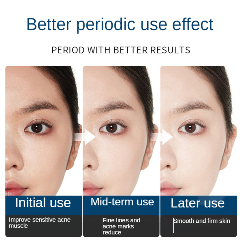Facial Repair Lyophilized Powd - مراجعة Oligopeptide Wrinkle وسعره