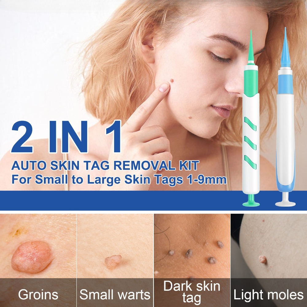 2-IN-1 Auto Skin Tag Removal T - مراجعة Luxury Skincare Acne وسعره