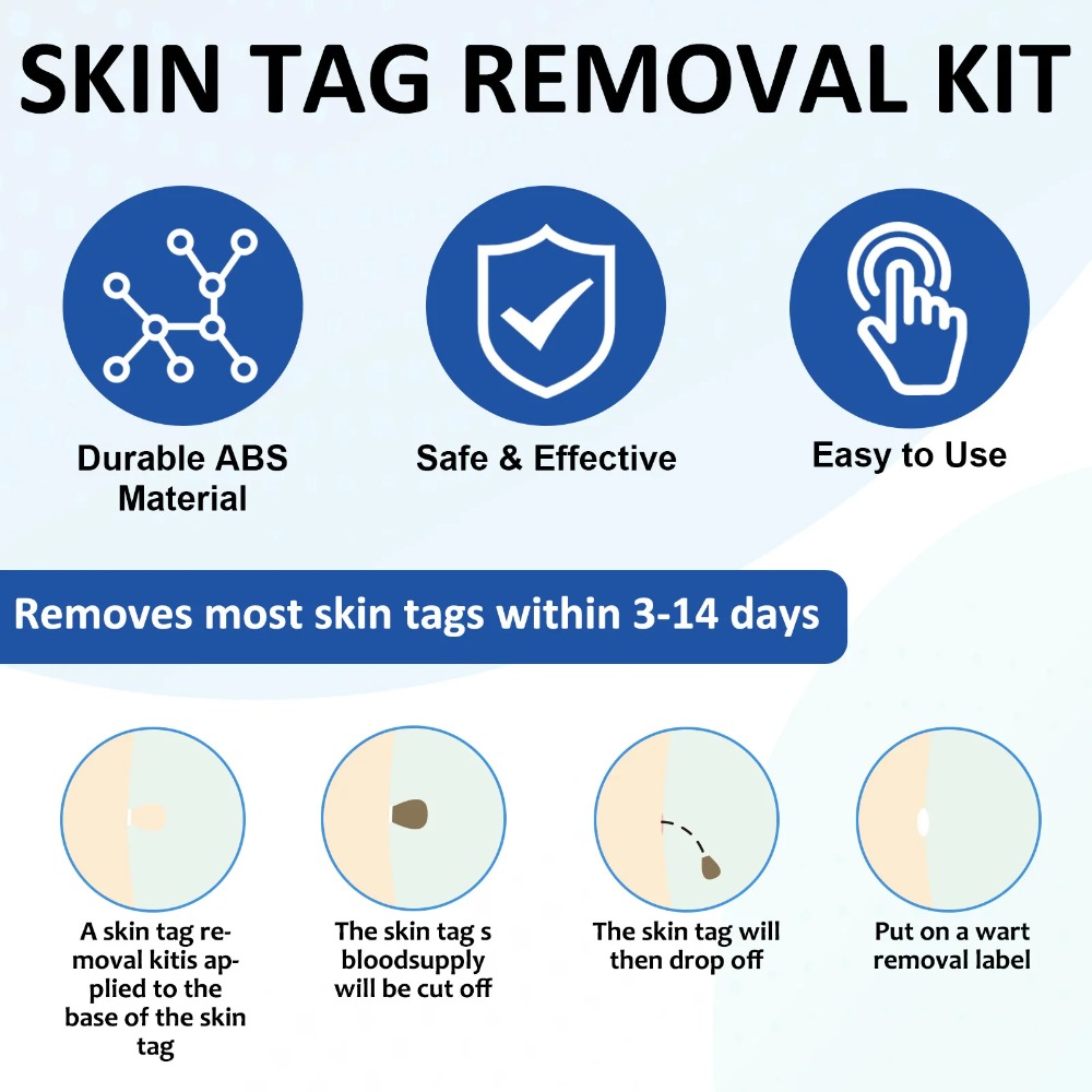 2-IN-1 Auto Skin Tag Removal T - مراجعة Luxury Skincare Acne وسعره