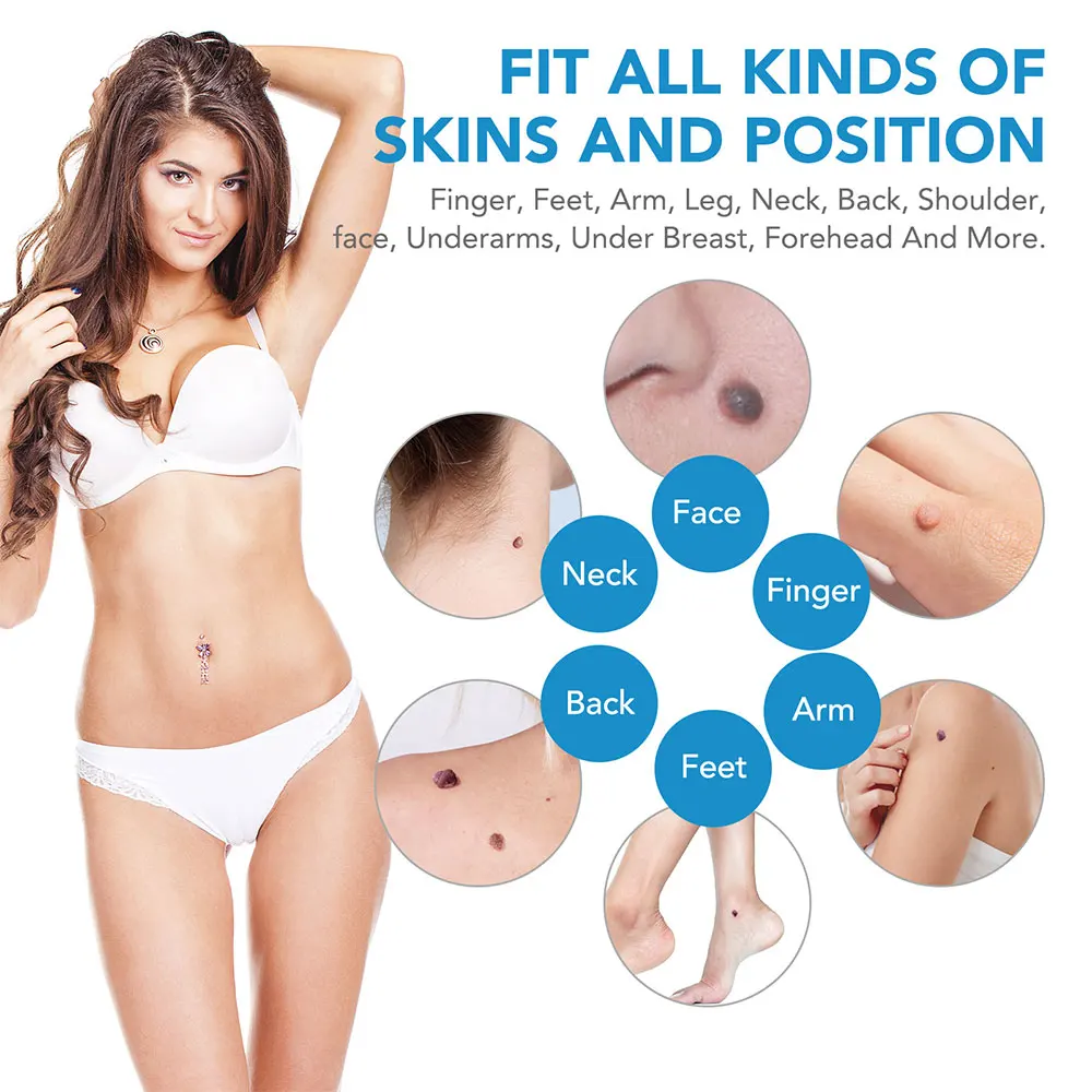 Auto Skin Tag Removal Tool Kit - مراجعة Luxury Skincare Acne وسعره