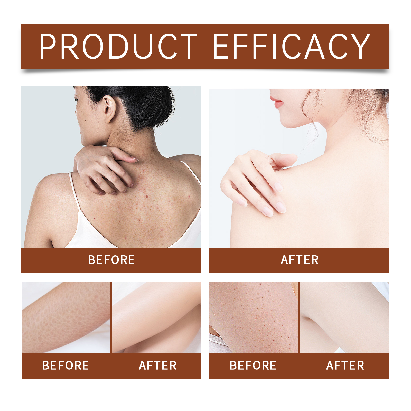 Luxury Body Oil for Dry Skin A - مراجعة Luxury Skincare Women وسعره