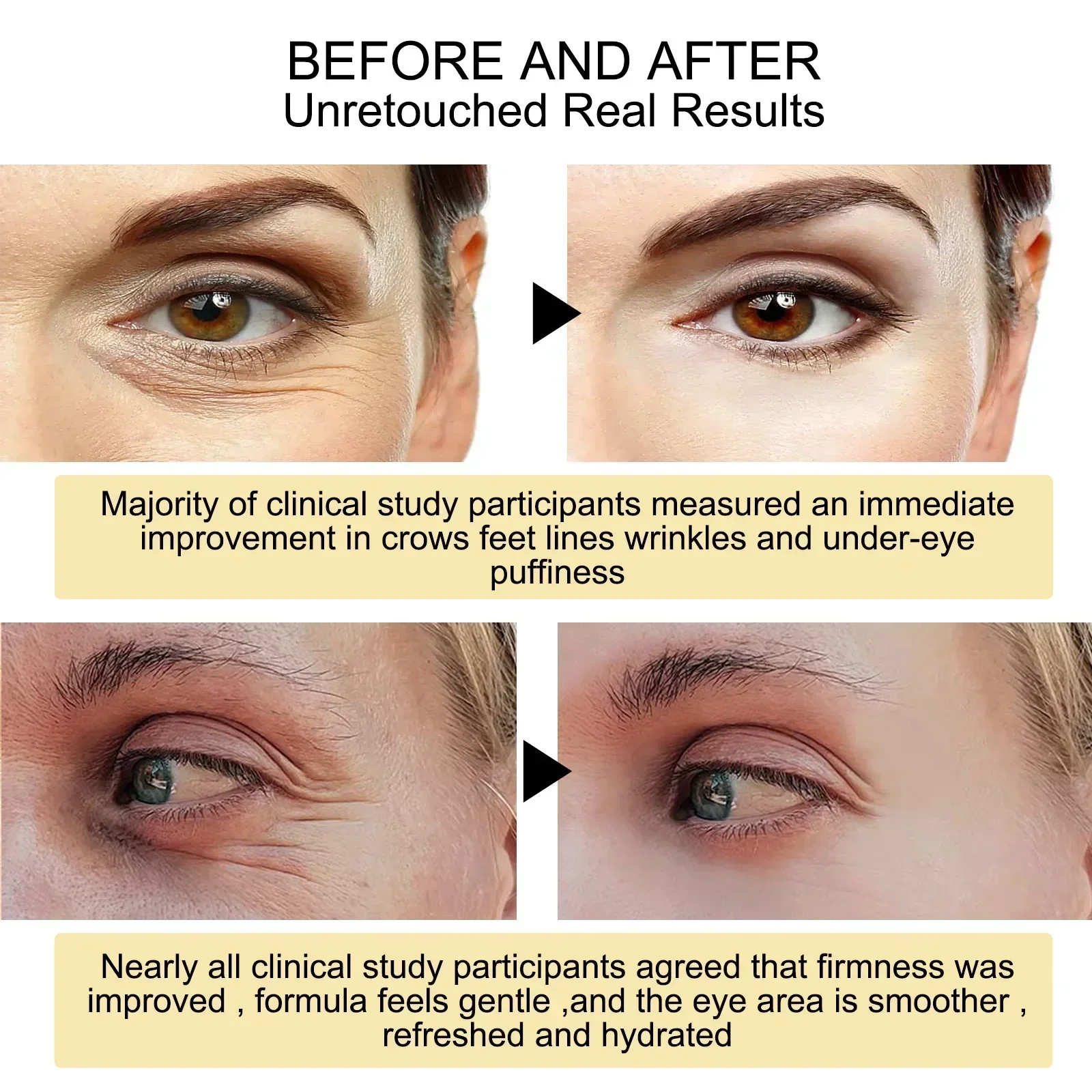 New 7 Day Tighten Wrinkles Eye - مراجعة Oligopeptide Wrinkle وسعره