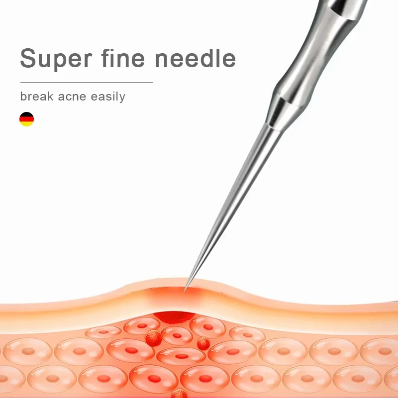 New German Style Blackhead Rem - مراجعة Luxury Skincare Acne وسعره