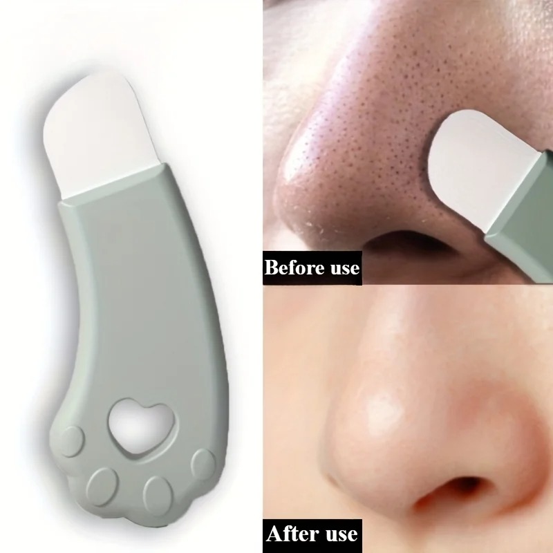 Cat Paw Blackhead Remover Tool - مراجعة Luxury Skincare Acne وسعره