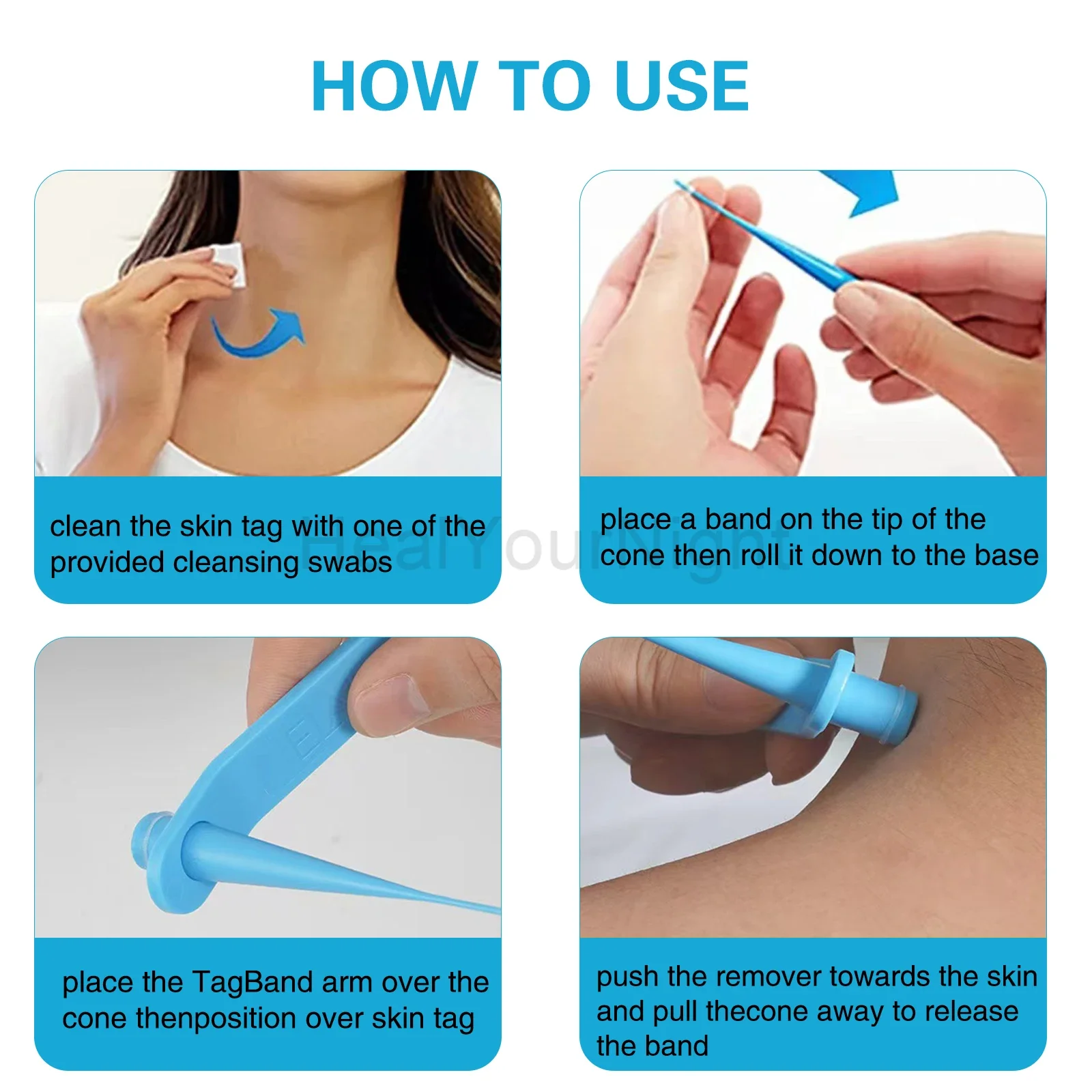 IDEABEL 3-IN-1 Auto Skin Tag R - مراجعة Luxury Skincare Acne وسعره